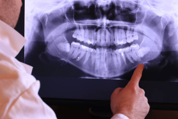 Best Emergency Tooth Extraction in Lowes Island, VA